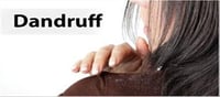 Home treatment: How to treat dandruff?
